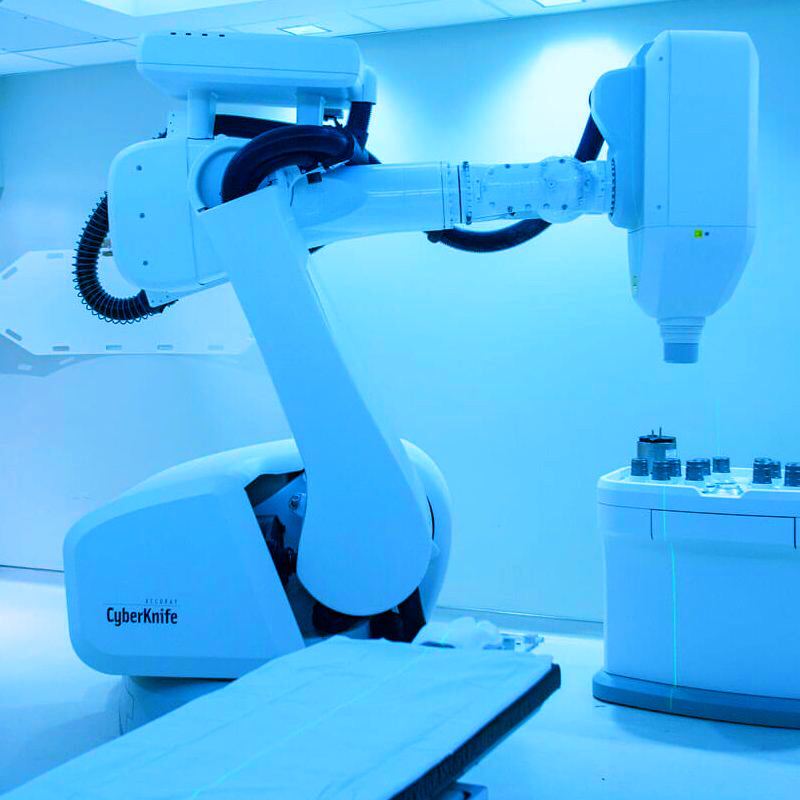 CyberKnife Cancer Treatment HYPOSTAT Study